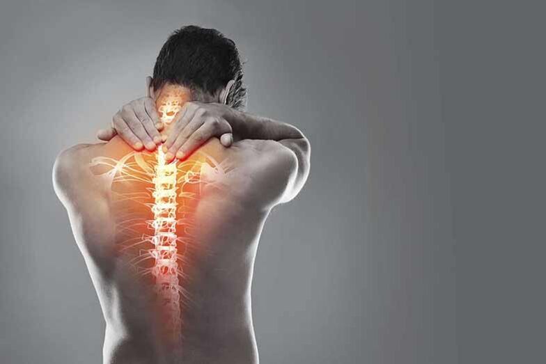 Gimdos kaklelio regiono osteochondrozė