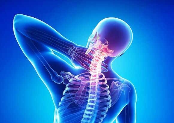 Gimdos kaklelio stuburo skausmas su osteochondroze