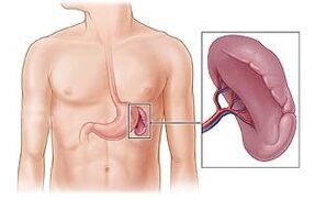 blužnies patologija kaip skausmo po kairiuoju pečių ašmenimis priežastis