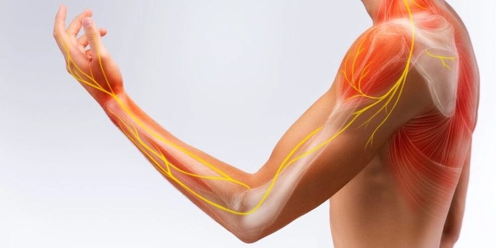 Pirštų skausmas ir tirpimas rodo raiščių pažeidimą dėl stenozuojančio ligamentito